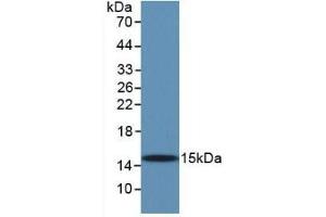 Detection of Recombinant TGFb1, Human using Monoclonal Antibody to Transforming Growth Factor Beta 1 (TGFb1)