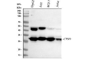 Western blot analysis of CTSD using anti-CTSD antibody (ABIN3044509).