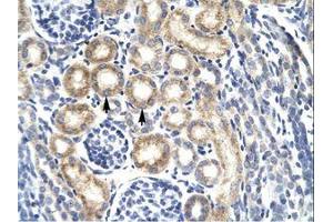 anti-Kv Channel Interacting Protein 3, Calsenilin (KCNIP3) (AA 70-119) antibody