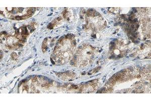 ABIN6277337 at 1/100 staining Human prostate tissue by IHC-P. (PAK4 anticorps  (Internal Region))
