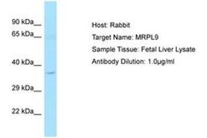 Image no. 1 for anti-Mitochondrial Ribosomal Protein L9 (MRPL9) (C-Term) antibody (ABIN6750216) (MRPL9 anticorps  (C-Term))