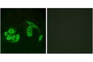 Immunofluorescence analysis of A549 cells, using GPR12 Antibody. (G Protein-Coupled Receptor 12 anticorps  (AA 1-50))
