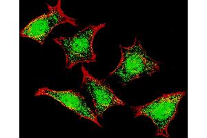Fluorescent confocal image of HeLa cells stained with Natriuretic Peptide Receptor C antibody.