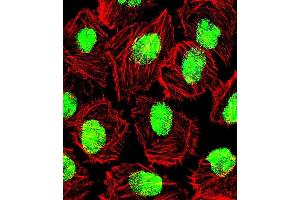 Fluorescent confocal image of U251 cell stained wit. (Nucleolin anticorps  (AA 276-304))