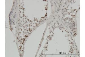 Immunoperoxidase of monoclonal antibody to MYC on formalin-fixed paraffin-embedded human testis. (c-MYC anticorps  (AA 330-439))