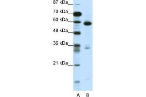 WB Suggested Anti-MBD1 Antibody Titration:  1. (MBD1 anticorps  (C-Term))