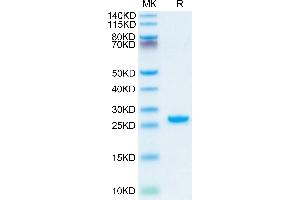 Rhesus macaque Complement Factor D on Tris-Bis PAGE under reduced condition.