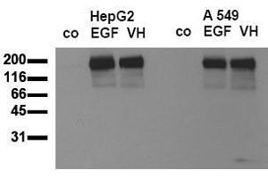 Western Blotting (WB) image for anti-Epidermal Growth Factor Receptor (EGFR) (pTyr869) antibody (ABIN126761) (EGFR anticorps  (pTyr869))