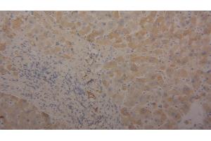 Detection of TF in Human Liver Tissue using Polyclonal Antibody to Transferrin (TF) (Transferrin anticorps  (AA 361-683))
