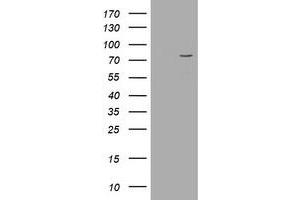 Image no. 17 for anti-Pogo Transposable Element with KRAB Domain (POGK) antibody (ABIN1500329)