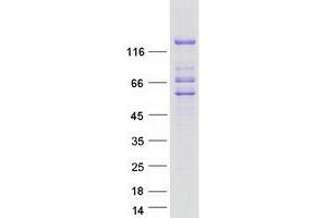 Lipin 2 Protein (LPIN2) (Myc-DYKDDDDK Tag)