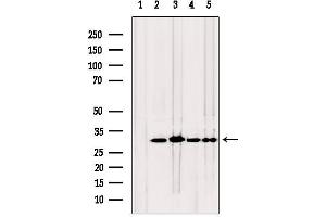 Western blot analysis of extracts from various samples, using TPI1 antibody.