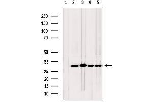 Western blot analysis of extracts from various samples, using TPI1 antibody. (TPI1 anticorps  (C-Term))