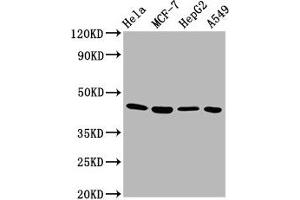 Western Blot Positive WB detected in: Hela whole cell lysate, MCF-7 whole cell lysate, HepG2 whole cell lysate, A549 whole cell lysate All lanes: GNA12 antibody at 5.