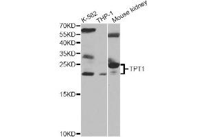 Western blot analysis of extracts of various cell lines, using TPT1 antibody. (TPT1 anticorps)