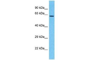 Host:  Rabbit  Target Name:  LRRC15  Sample Type:  721_B Whole Cell lysates  Antibody Dilution:  1. (LRRC15 anticorps  (N-Term))