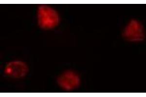 anti-Cyclin-Dependent Kinase 7 (CDK7) (Internal Region) antibody
