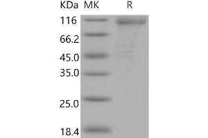 Western Blotting (WB) image for CD36 (CD36) (Active) protein (His tag,Fc Tag) (ABIN7320283)