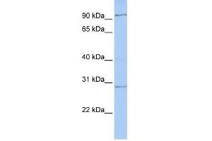 HMX2 antibody used at 0. (HMX2 anticorps  (Middle Region))