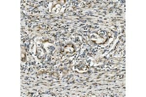 IHC analysis of SGK1 using anti-SGK1 antibody (ABIN7603118). (SGK1 anticorps  (N-Term))