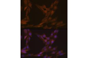 Immunofluorescence analysis of NIH-3T3 cells using KIFC1 Rabbit mAb (ABIN1680485, ABIN3015039, ABIN3015040 and ABIN7101305) at dilution of 1:100 (40x lens).
