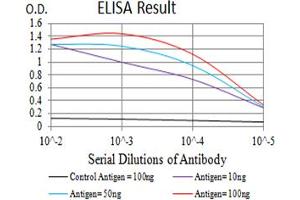 Black line: Control Antigen (100 ng),Purple line: Antigen (10 ng), Blue line: Antigen (50 ng), Red line:Antigen (100 ng)