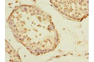Immunohistochemistry of paraffin-embedded human testis tissue using ABIN7170766 at dilution of 1:100 (STAR anticorps  (AA 64-285))