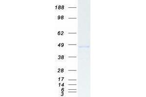 Validation with Western Blot