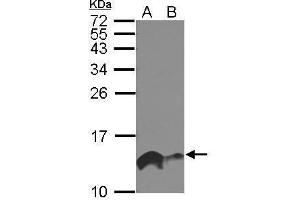 WB Image Sample (30 ug of whole cell lysate) A: A549 B: HeLa 15% SDS PAGE antibody diluted at 1:1000 (IFITM1 anticorps)