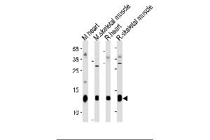 PLM Antibody (E1) (ABIN1882173 and ABIN2844827) western blot analysis in mouse heart,skeletal muscle and rat heart,skeletal muscle tissue lysates (35 μg/lane). (FXYD1 anticorps  (N-Term))