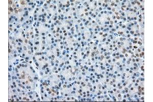 Immunohistochemical staining of paraffin-embedded Human colon tissue using anti-H6PD mouse monoclonal antibody. (Glucose-6-Phosphate Dehydrogenase anticorps)