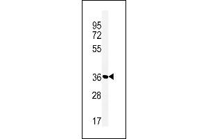 Western blot analysis of MFRN2 Antibody (N-term) (ABIN651437 and ABIN2840240) in Jurkat cell line lysates (35 μg/lane). (SLC25A28 anticorps  (N-Term))