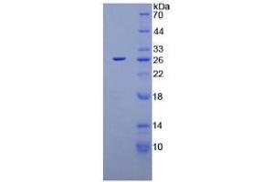 SDS-PAGE analysis of Rat XPC Protein. (XPC Protéine)
