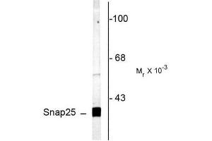 Image no. 1 for anti-Synaptosomal-Associated Protein, 25kDa (SNAP25) (C-Term) antibody (ABIN372714) (SNAP25 anticorps  (C-Term))