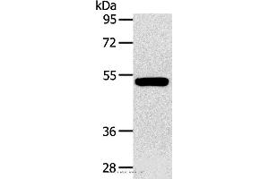 Western blot analysis of Human fetal muscle tissue, using GJA9 Polyclonal Antibody at dilution of 1:400 (GJA9 anticorps)