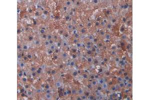 Used in DAB staining on fromalin fixed paraffin- embedded kidney tissue (CYP17A1 anticorps  (AA 201-507))