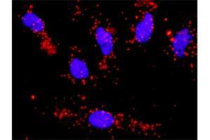 Proximity Ligation Analysis of protein-protein interactions between PTK2 and CCNA1.
