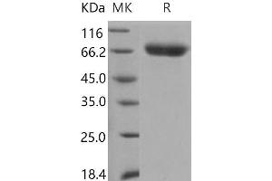 Western Blotting (WB) image for serpin Peptidase Inhibitor, Clade D (Heparin Cofactor), Member 1 (SERPIND1) (Active) protein (His tag) (ABIN7197974)