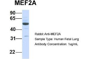 Host:  Rabbit  Target Name:  MEF2A  Sample Type:  Human Fetal Lung  Antibody Dilution:  1. (MEF2A anticorps  (Middle Region))