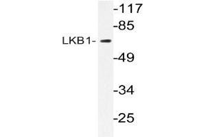 Western blot (WB) analyzes of LKB1 antibody in extracts from CV-1cells. (LKB1 anticorps)