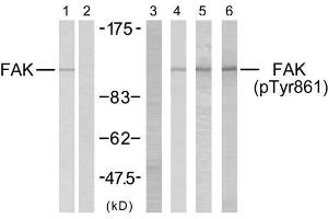 Western blot analysis using FAK (Ab-861) antibody (E021076, Lane 1 and 2) and FAK (phospho-Tyr861) antibody (E011059, Lane 3, 4, 5 and 6). (FAK anticorps)
