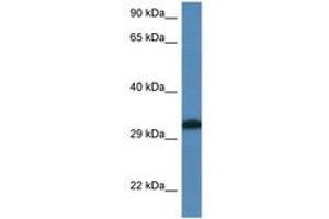 Image no. 1 for anti-Distal-Less Homeobox 6 (DLX6) (C-Term) antibody (ABIN6747317) (DLX6 anticorps  (C-Term))