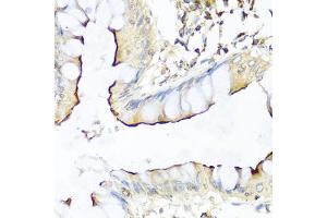 Immunohistochemistry of paraffin-embedded human colon using NRG4 antibody (ABIN1873958) at dilution of 1:100 (40x lens). (Neuregulin 4 anticorps)