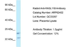 Western Blotting (WB) image for anti-RAS-Like, Family 11, Member B (RASL11B) (C-Term) antibody (ABIN2789132) (RASL11B anticorps  (C-Term))
