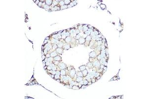 Immunohistochemistry of paraffin-embedded rat testis using SSTR5 Rabbit mAb (ABIN7270495) at dilution of 1:100 (40x lens).