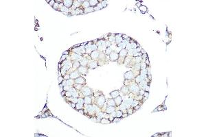 Immunohistochemistry of paraffin-embedded rat testis using SSTR5 Rabbit mAb (ABIN7270495) at dilution of 1:100 (40x lens). (SSTR5 anticorps)