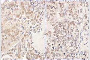 Immunohistochemistry (IHC) image for anti-Poly-U Binding Splicing Factor 60KDa (PUF60) (AA 509-559) antibody (ABIN7454555)