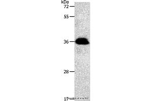 Western blot analysis of Jurkat cell, using PPP2CB Polyclonal Antibody at dilution of 1:1200 (PPP2CB anticorps)