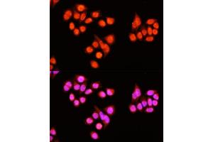 Immunofluorescence analysis of Hela cells using ZNF408 antibody  at dilution of 1:100 (40x lens). (ZNF408 anticorps  (AA 1-240))