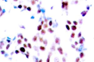 Image no. 2 for anti-Collagen, Type XVIII, alpha 1 (COL18A1) (Chain alpha 1) antibody (ABIN265401) (COL18A1 anticorps  (Chain alpha 1))